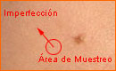 Corrección de Imperfeccciones con el Pincel Corrector